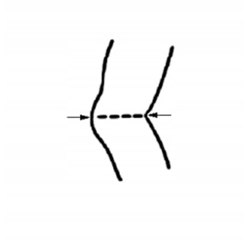 Suport Stabilizare Genunchi Prindere si Fixare Velcro, Pozitie Sub Genunchi